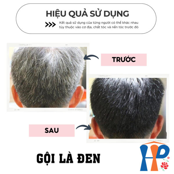 Gội nhuộm tóc thảo dược TopCharm Herbal Hair Colour Shampoo 250ml (phủ bạc nâu - Brown hoặc đen - Black)