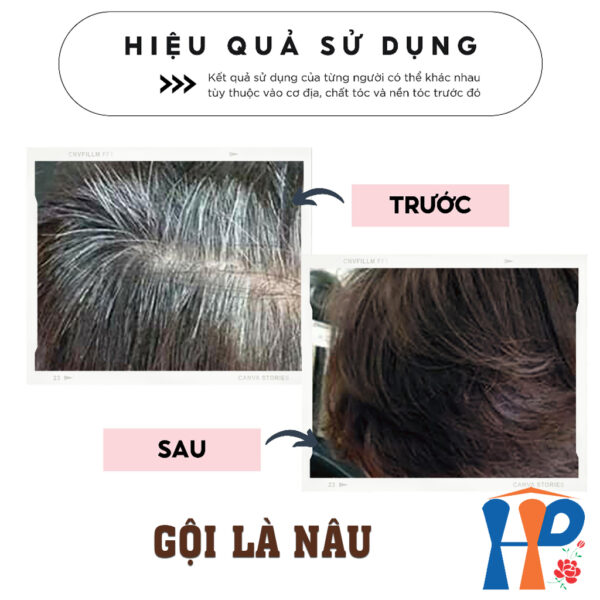 Gội nhuộm tóc thảo dược TopCharm Herbal Hair Colour Shampoo 250ml (phủ bạc nâu - Brown hoặc đen - Black)